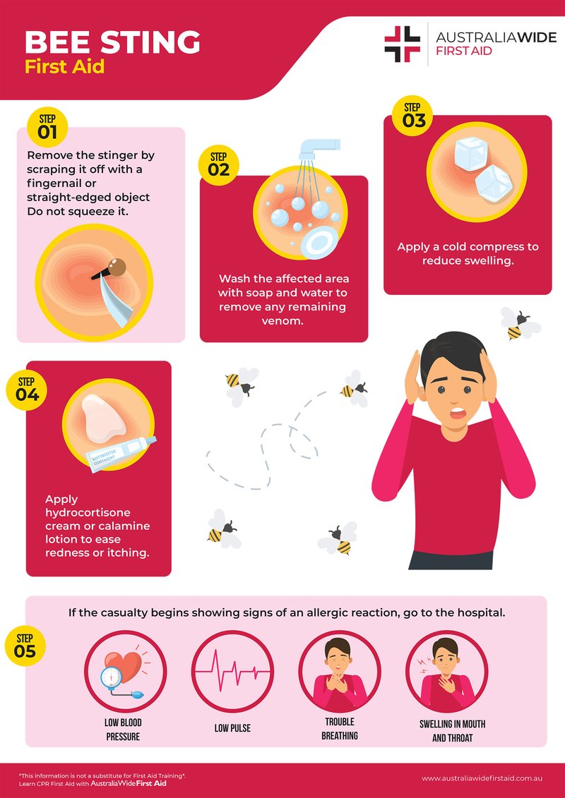 Bee Stings – Treatment, Allergies, And First Aid