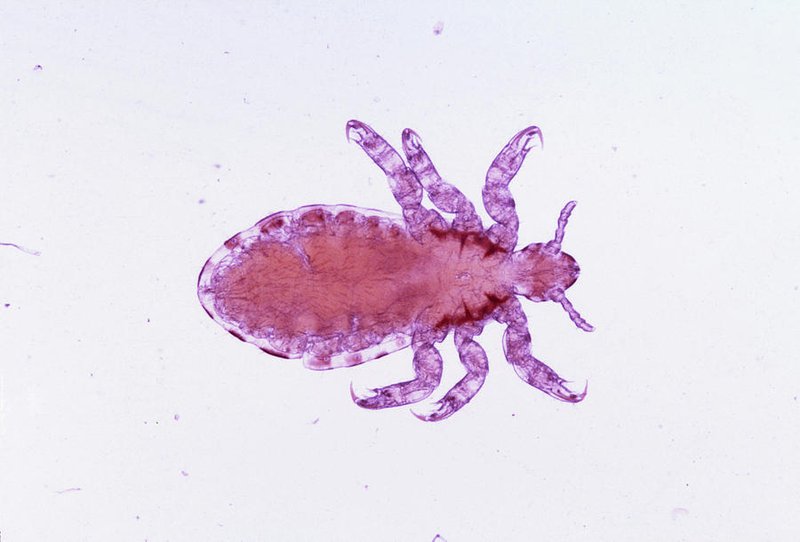 Louse