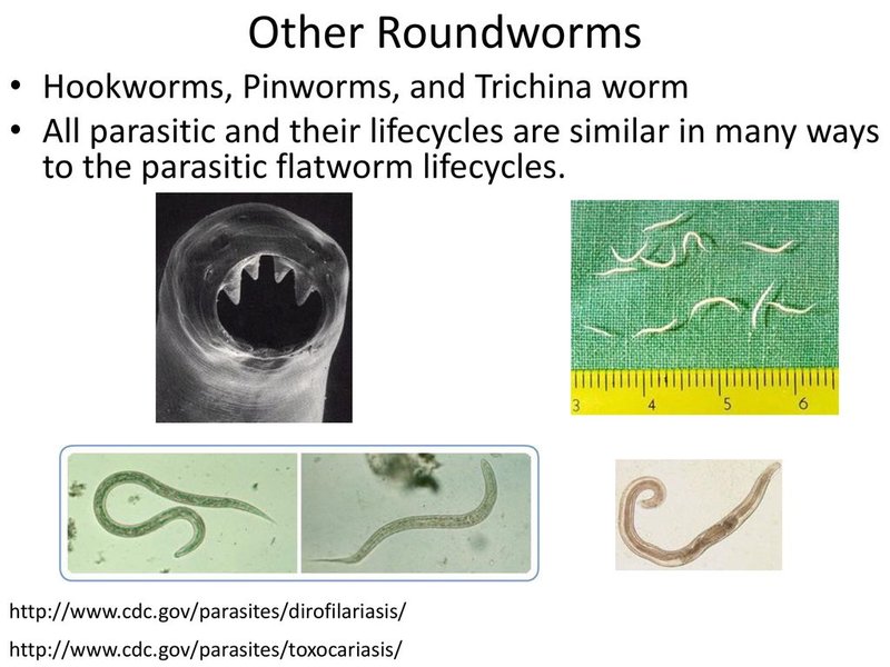 Comparing Hookworm To Similar Worm Species In The Same Habitat