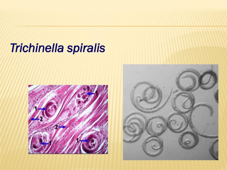 Comparing Trichinella Spiralis To Similar Worm Species In The Same Habitat