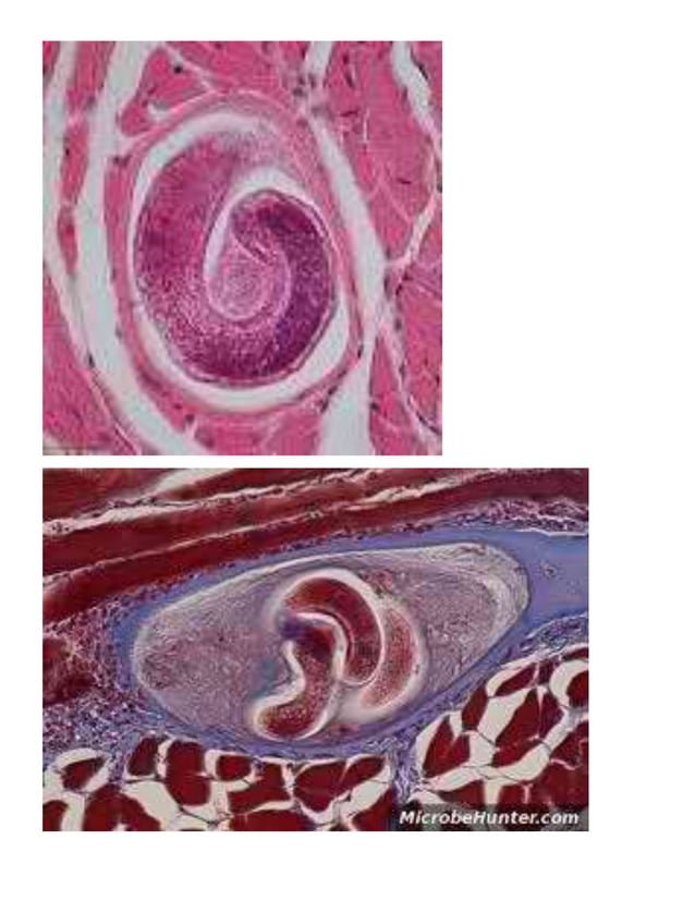 Documenting The Behavior Of Pinworm With Field Cameras