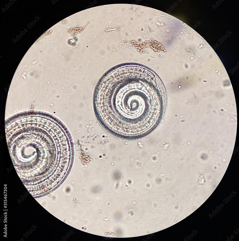 Documenting The Behavior Of Trichinella Spiralis With Field Cameras