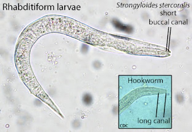 Field Identification Challenges When Spotting A Hookworm