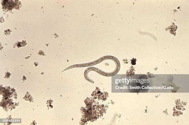 Field Identification Challenges When Spotting A Microworm