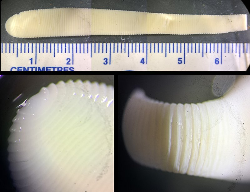 Field Identification Challenges When Spotting A Tapeworm