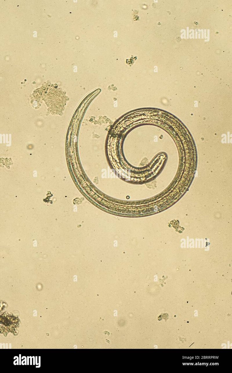 Field Identification Challenges When Spotting A Trichinella Spiralis