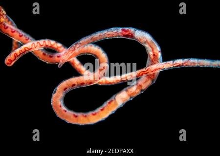 Field Identification Challenges When Spotting A Tubifex Worm