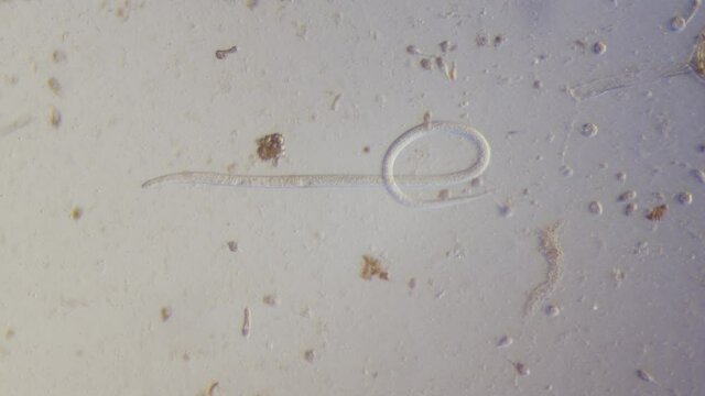 Field Identification Challenges When Spotting A Whipworm