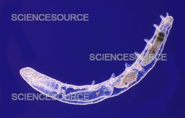 Habitat Preferences Of The Freshwater Oligochaete In The Wild