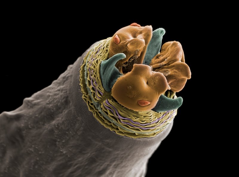 Habitat Preferences Of The Microworm In The Wild