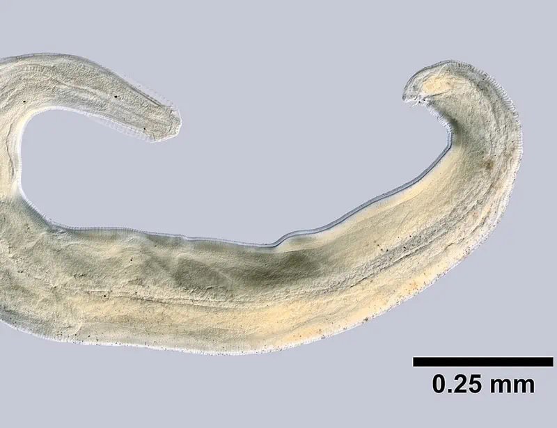 Habitat Preferences Of The Pinworm In The Wild