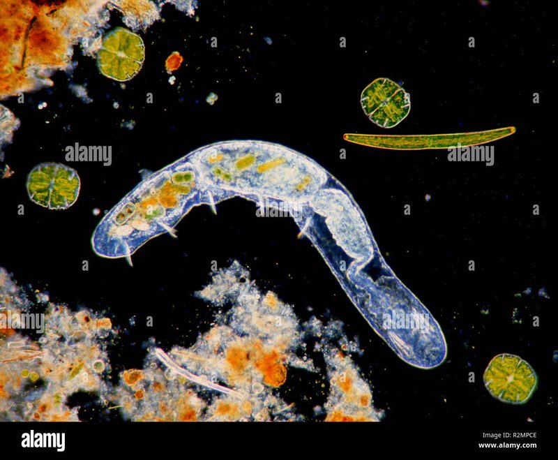How Freshwater Oligochaete Interacts With Other Microfauna In Its Ecosystem