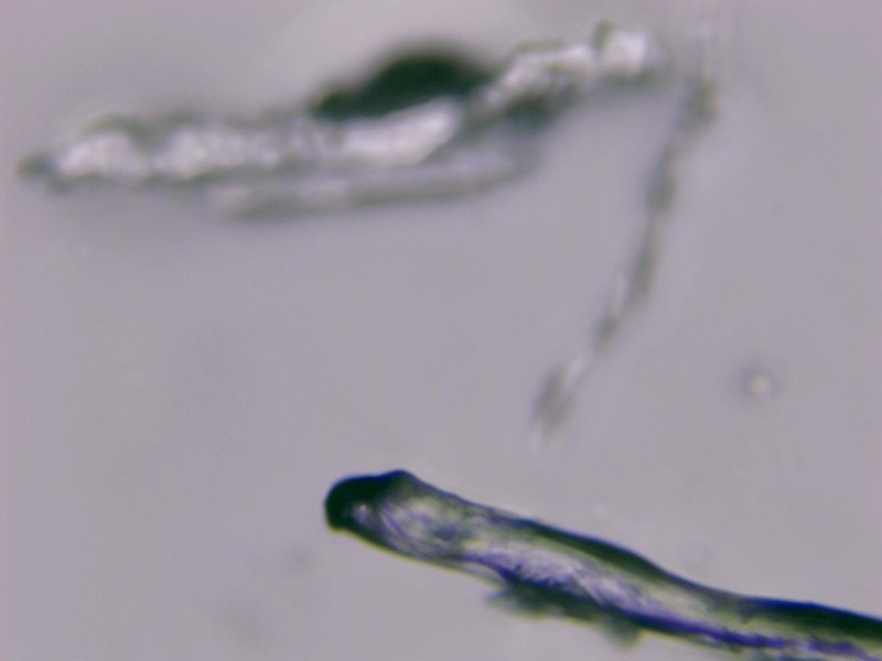 How Nematomorph Interacts With Other Microfauna In Its Ecosystem