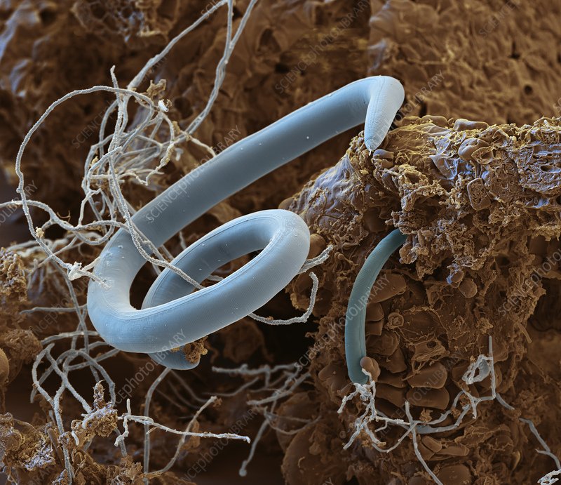 How Roundworm Interacts With Other Microfauna In Its Ecosystem
