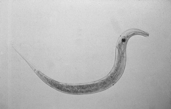 How To Identify A Pinworm In Its Natural Habitat