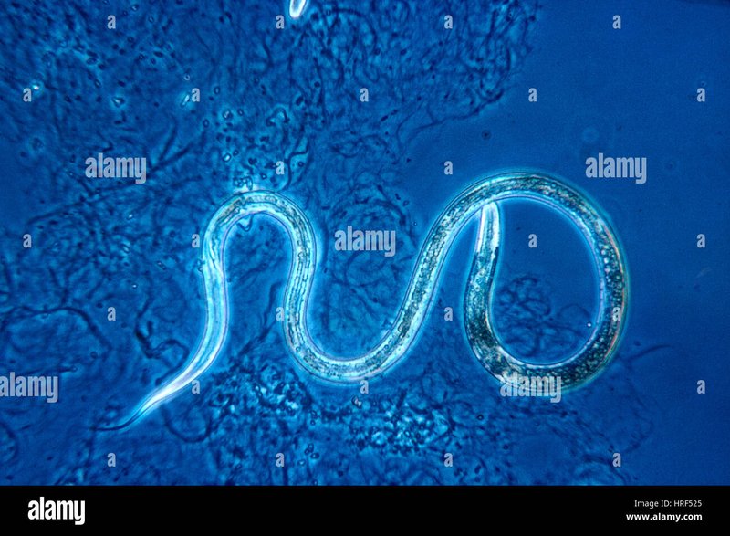 How Vinegar Eel Interacts With Other Microfauna In Its Ecosystem