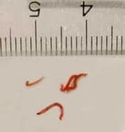 Life Cycle Of The Bloodworm: Stages And Behavior
