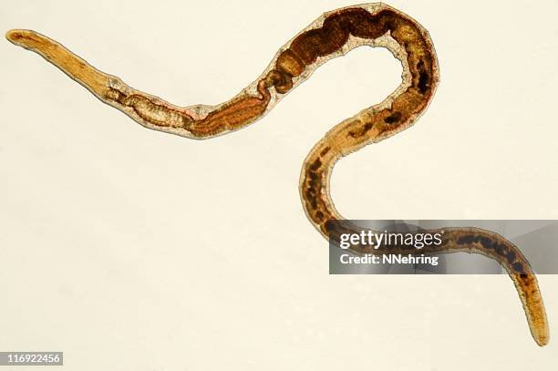 The Feeding Mechanism Of Segmented Worm Explained Step-By-Step