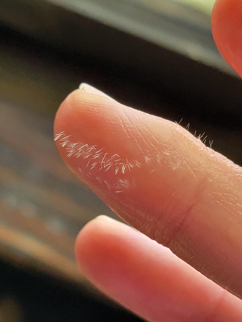 Treating A Bristle Worm Bite: Symptoms And Remedies