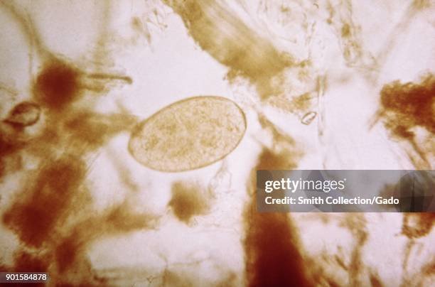 Trematode In Captivity: Can They Be Studied Or Farmed?