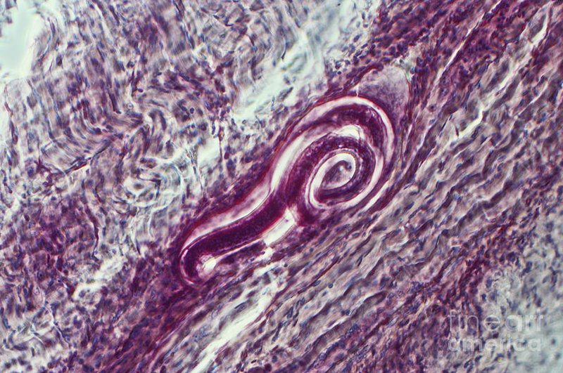 Trichinella Spiralis And Its Role In Soil Or Aquatic Ecosystems