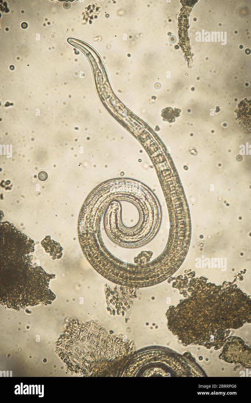 Trichinella Spiralis In Captivity: Can They Be Studied Or Farmed?