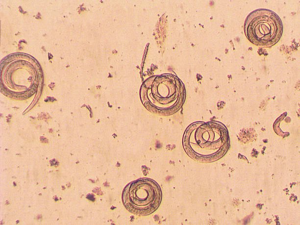 Trichinella Spiralis Reproduction: Mating, Eggs, And Larvae Facts