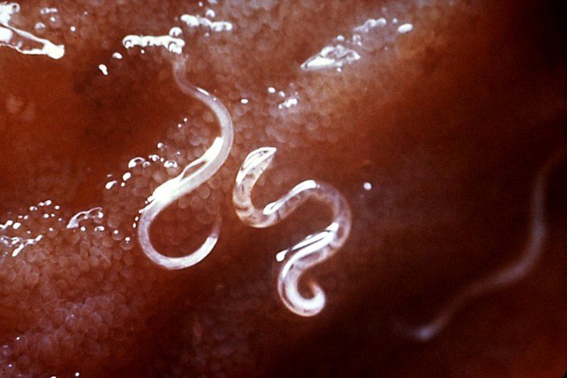 Using Hookworm In School Science Demonstrations