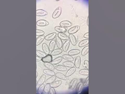 Using Pinworm In School Science Demonstrations