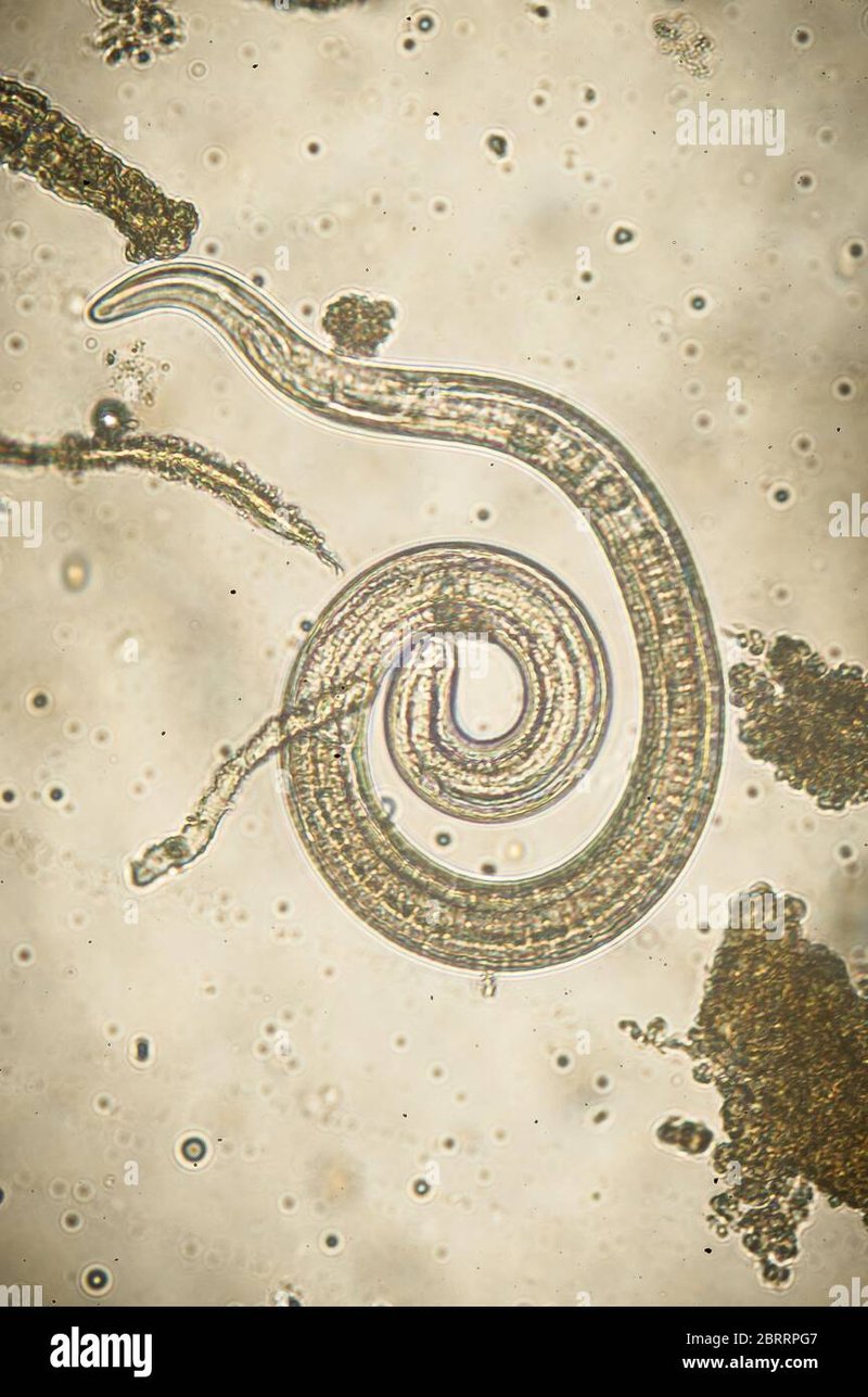 Using Trichinella Spiralis For Environmental Monitoring Or Bioindication