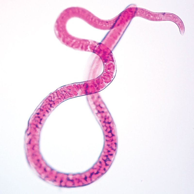 Using Trichinella Spiralis In School Science Demonstrations