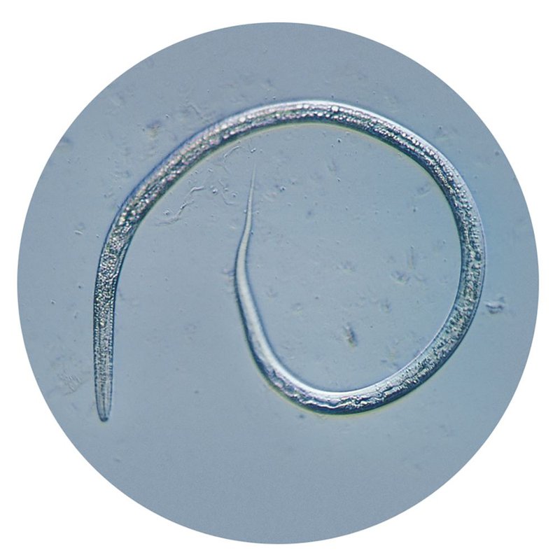 Using Vinegar Eel For Environmental Monitoring Or Bioindication