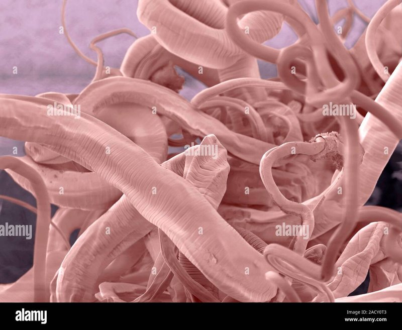 Using Whipworm For Environmental Monitoring Or Bioindication