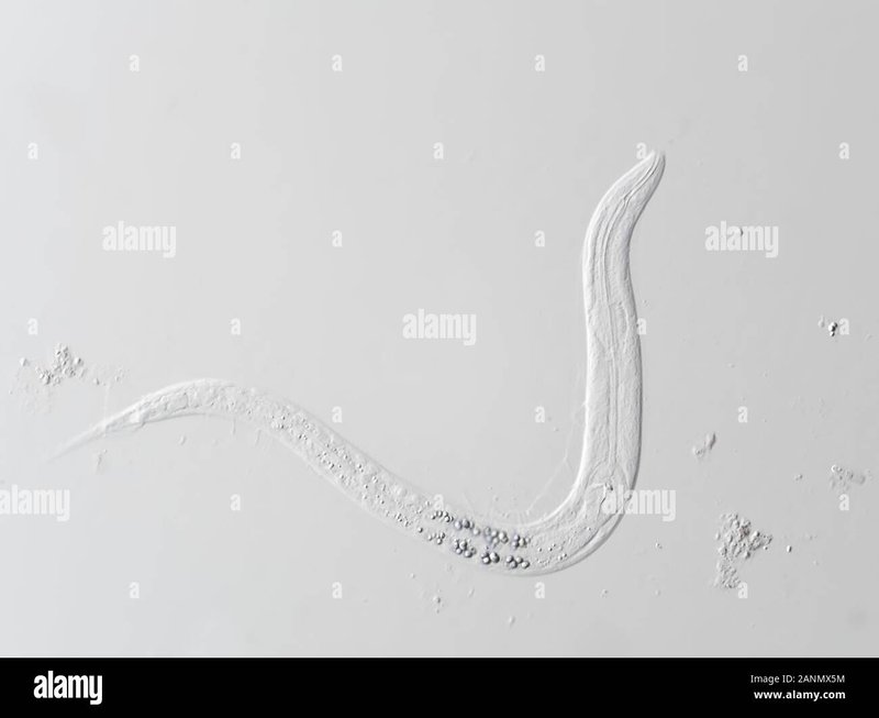 What Is A Microworm? A Naturalist’S Overview