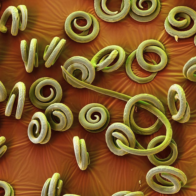 What Is A Trichinella Spiralis? A Naturalist’S Overview