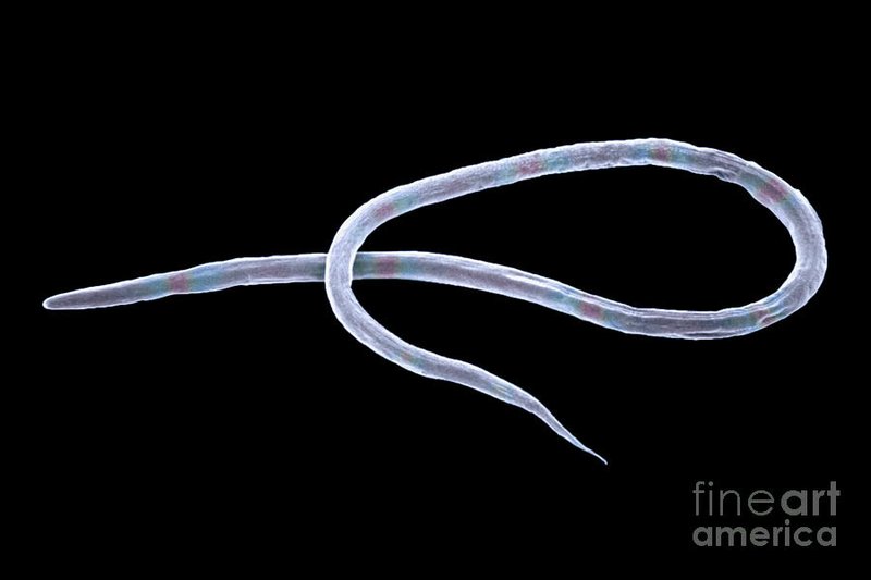 What Is A Vinegar Eel? A Naturalist’S Overview